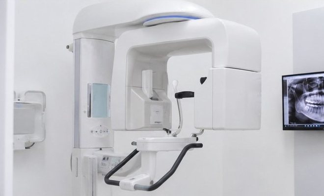 DVT